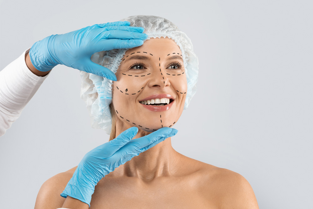 Face Lift (Rhytidectomy)